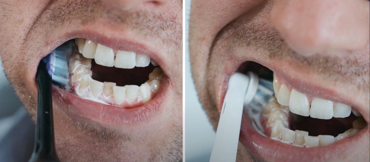 Sonicare brush head being used next to Oral-B brush head