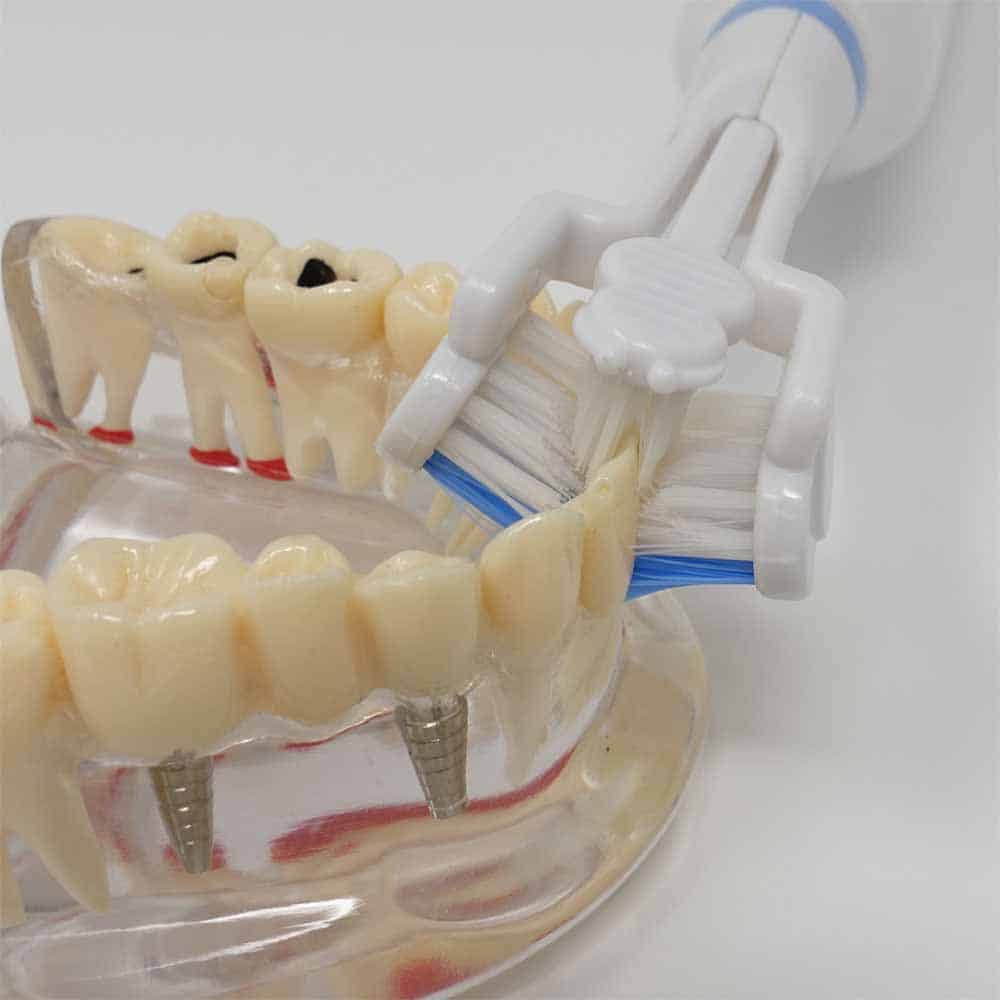 Triple Bristle toothbrush on model teeth